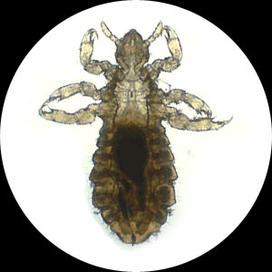Body Lice Images