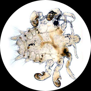 scabies bug pictures